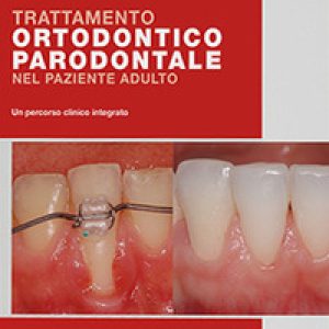 Trattamento ortodontico parodontale nel paziente adulto. Un percorso clinico integrato