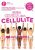 Guida cinica alla cellulite